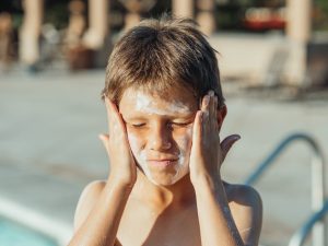 علاج حروق الشمس -Treating sunburn