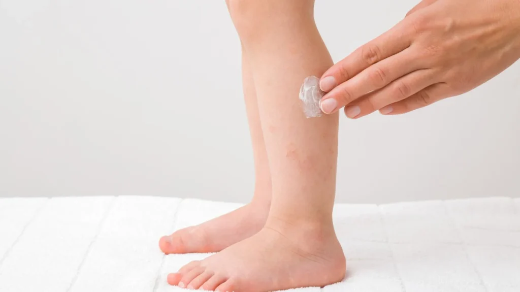 Summer allergy in children: How to help your children deal with allergy symptoms